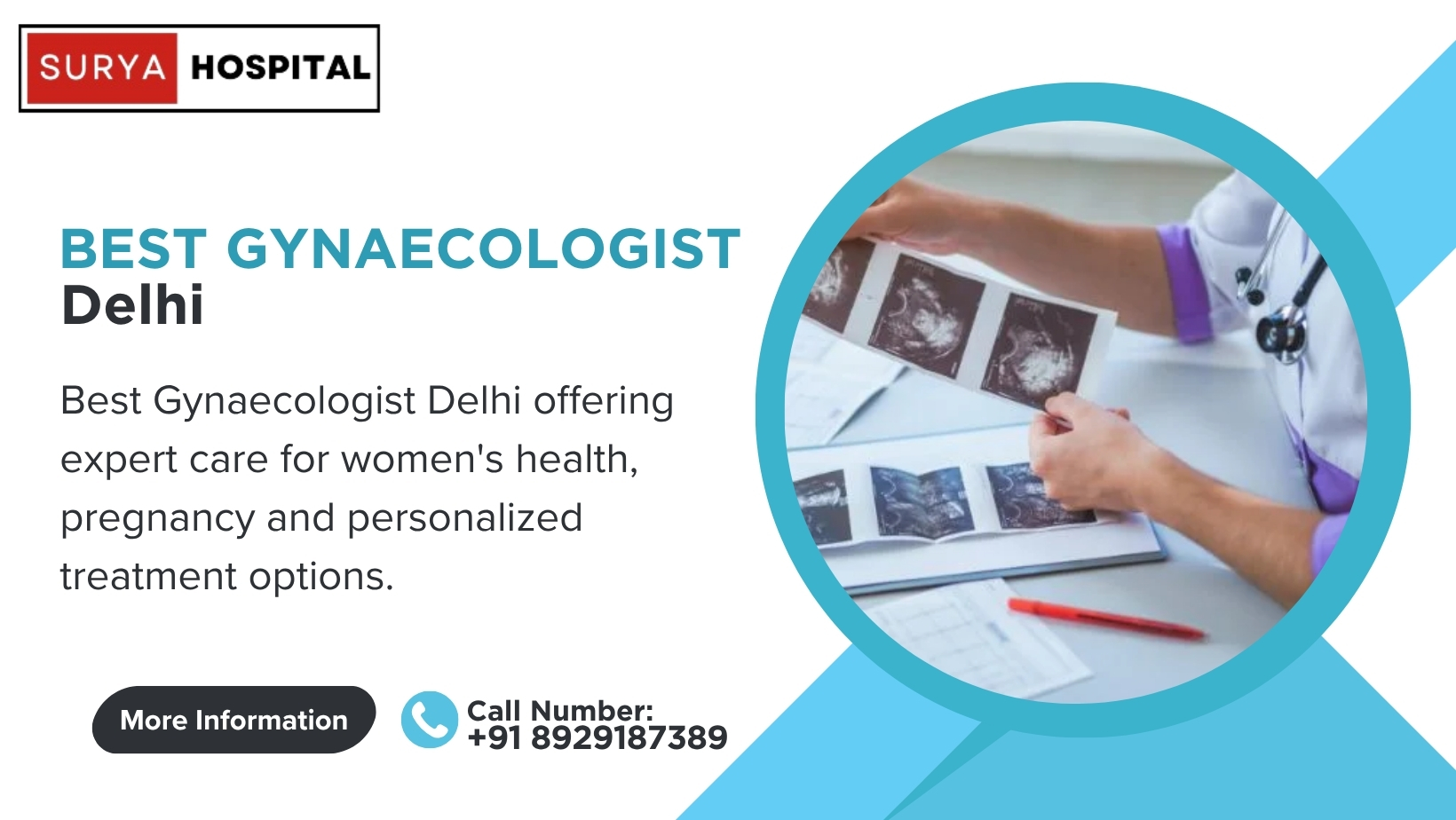 Best Gynaecologist Delhi for Expert Women’s Care